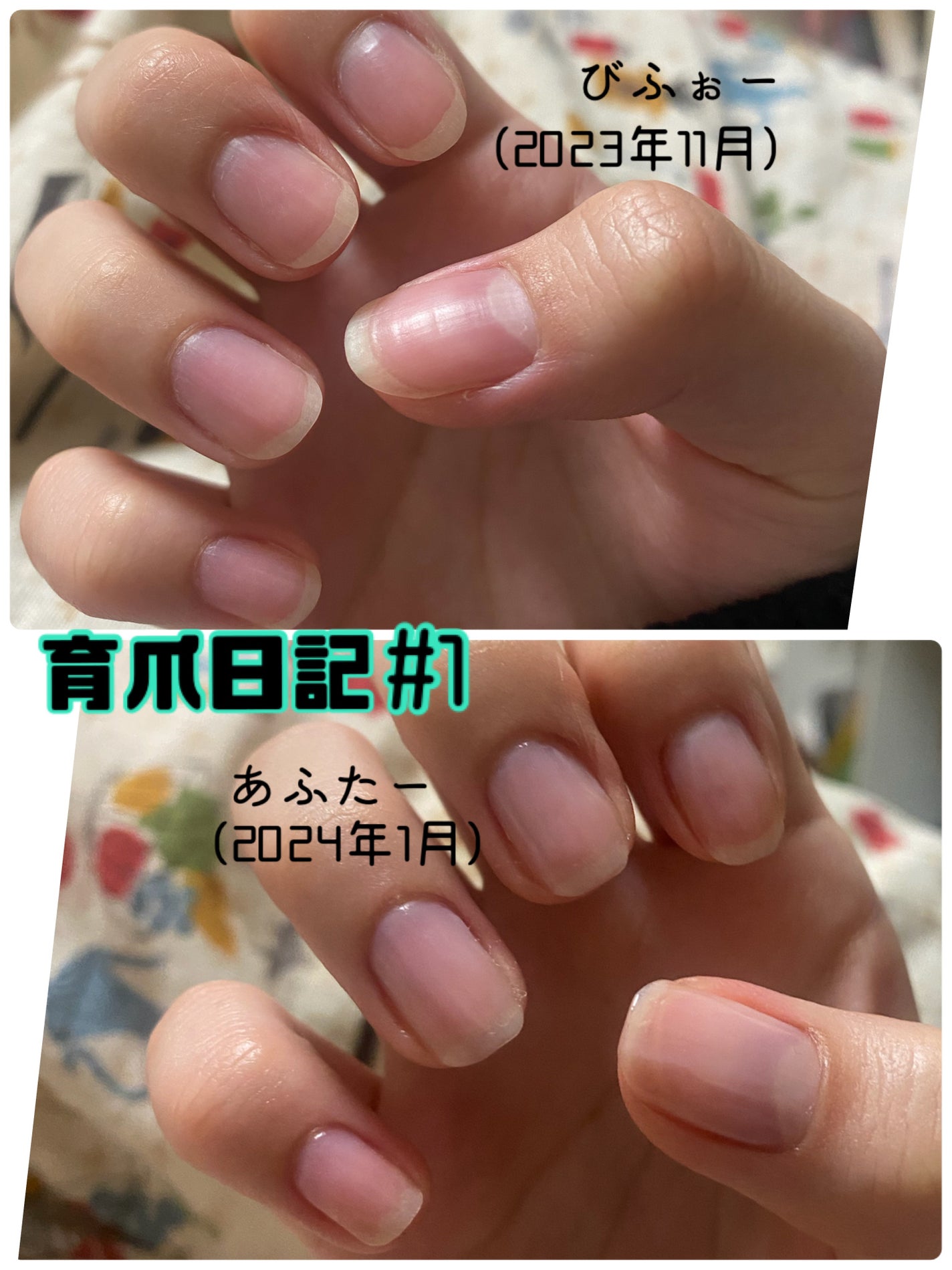 夏秋 on LIPS 「(育爪日記#1)今回は育爪を本格的に始めて2ヶ月が経過した時点..」(1枚目)