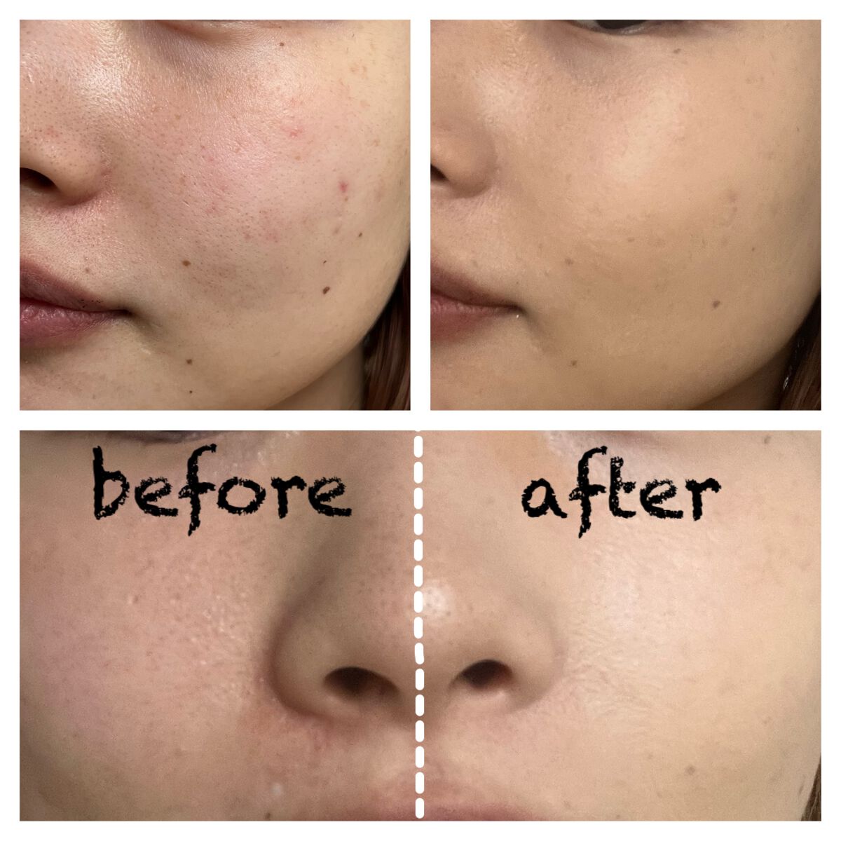 タンイドル ウルトラ ウェア リキッド/LANCOME/リキッドファンデーションを使ったクチコミ(2枚目)