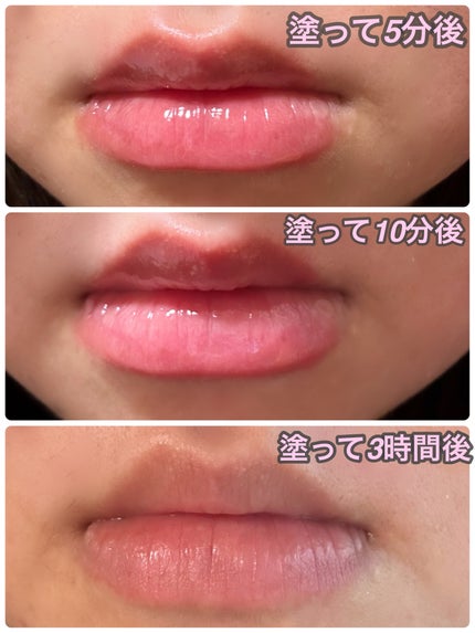 ボリュームリッププランパー/BANILA CO/リッププランパーを使ったクチコミ(5枚目)