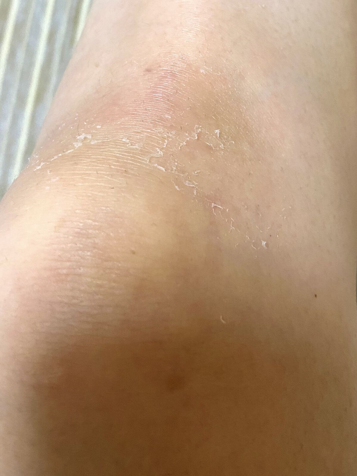 レチノールA 1% アドバンスドリバイタリゼーションクリーム/Life-flo/フェイスクリームを使ったクチコミ（1枚目）