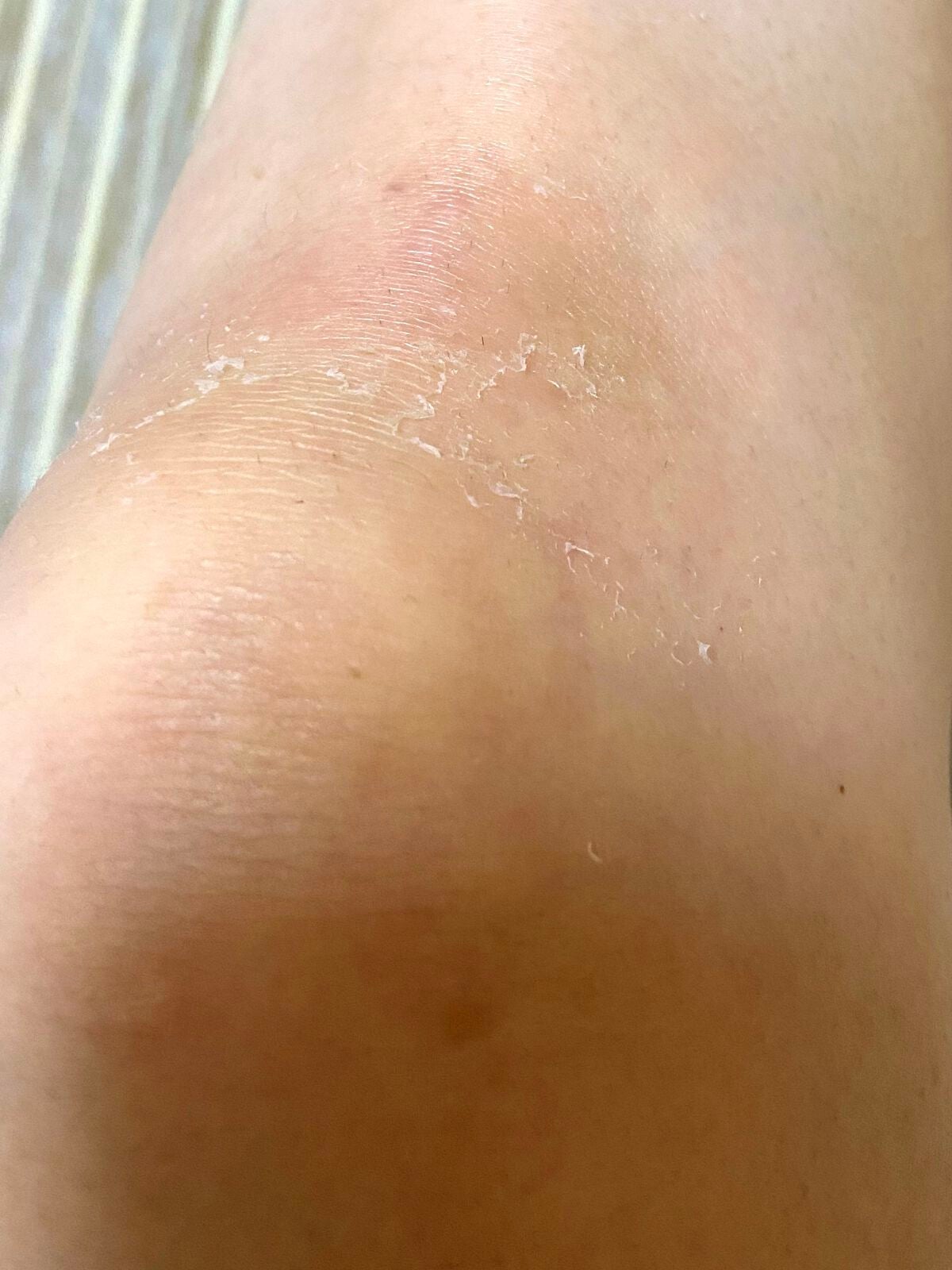 レチノールA 1% アドバンスドリバイタリゼーションクリーム/Life-flo/フェイスクリームを使ったクチコミ(1枚目)