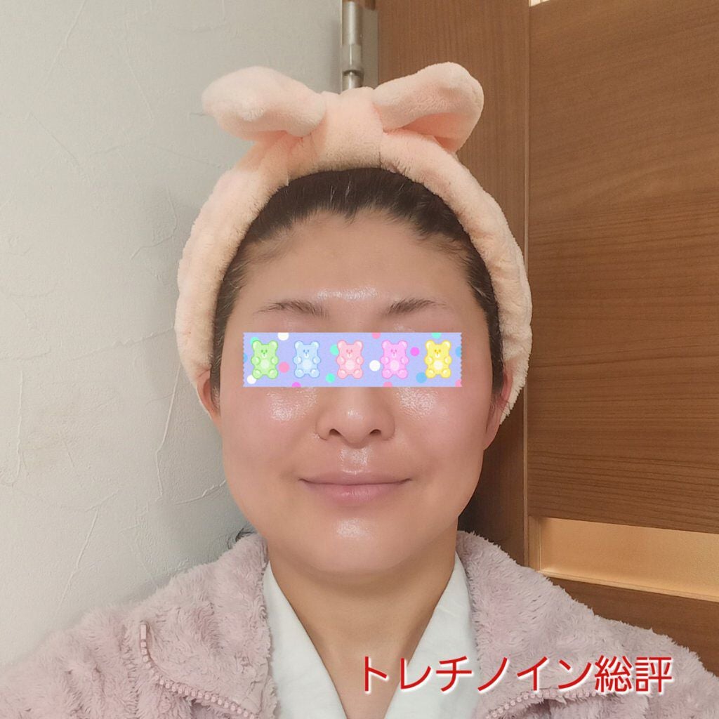 トレチノインジェル/A-Ret/美容液を使ったクチコミ(1枚目)