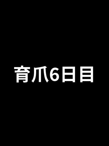 ネイルトリートメント N/ネイルネイル/ネイルオイル・トリートメントを使ったクチコミ（1枚目）