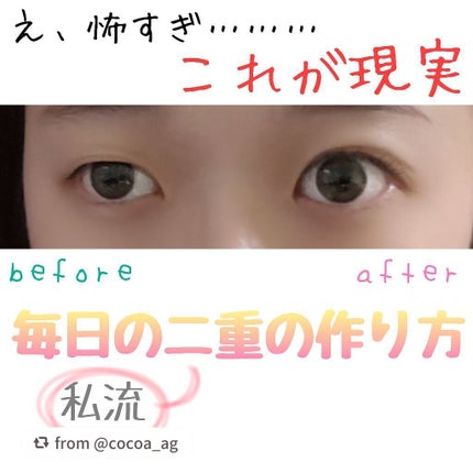 アイトーク スーパーホールド/アイトーク/二重まぶた用アイテムを使ったクチコミ(1枚目)