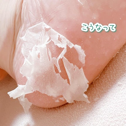 あしやすめ 足裏角質ケアパック/鎌倉ライフ/レッグ・フットケアを使ったクチコミ(6枚目)