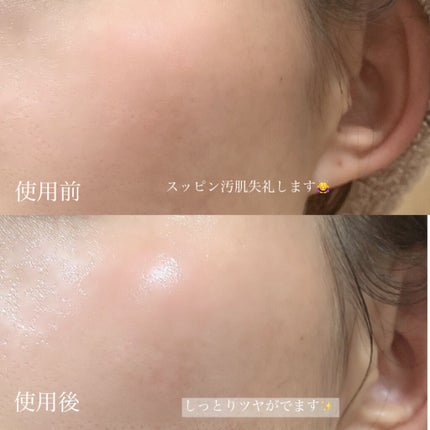 ローションモイスト/ELECTRON/化粧水を使ったクチコミ(6枚目)