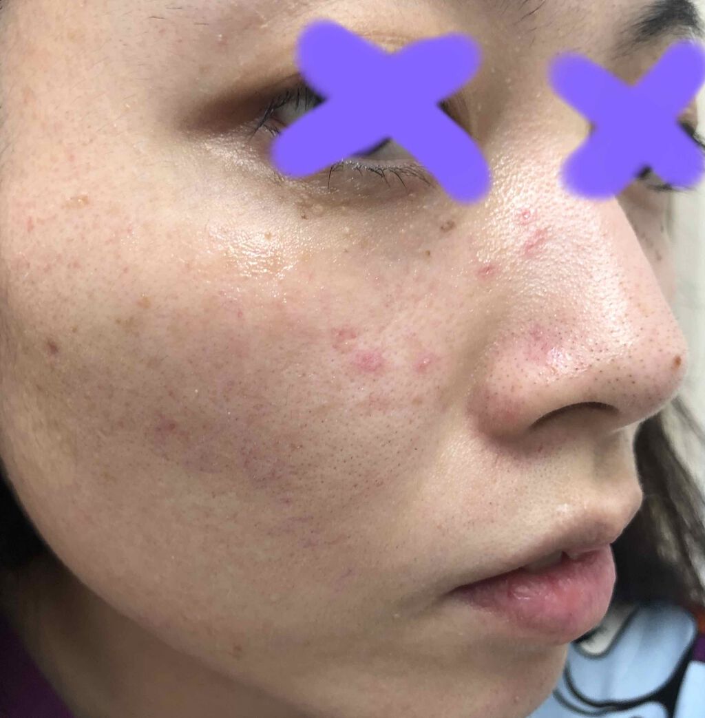 まな@YouTube on LIPS 「※iPhoneの純正カメラ加工なしでございます!!!⚠️さぁ、..」(3枚目)