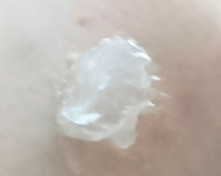 Dermal アロエベラゲル 99%のクチコミ「 火傷を早く、簡単に治す方法♪
・まず、画像2ぐらい、盛り上がるぐらいたっぷりアロエベラゲル.....」(3枚目)