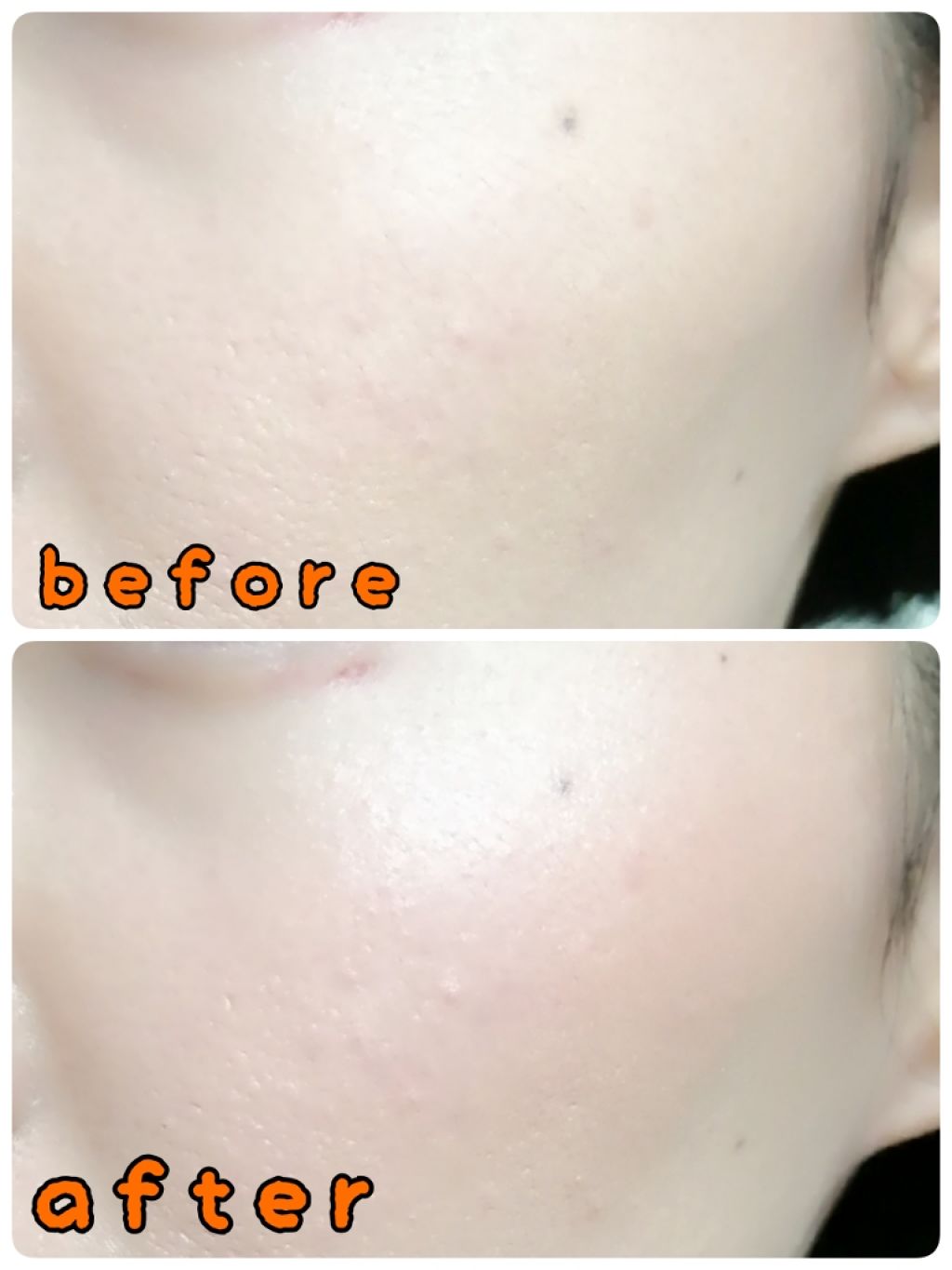 グロウフルールチークス/キャンメイク/パウダーチークを使ったクチコミ（3枚目）