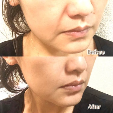 深緑(ふかみどり) エニシグローパック30回分 | www.dhzeneiskola.hu