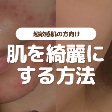 たまのみこと on LIPS 「今回は超敏感肌の方向けに！肌を綺麗にする方法について投稿にまと..」（1枚目）