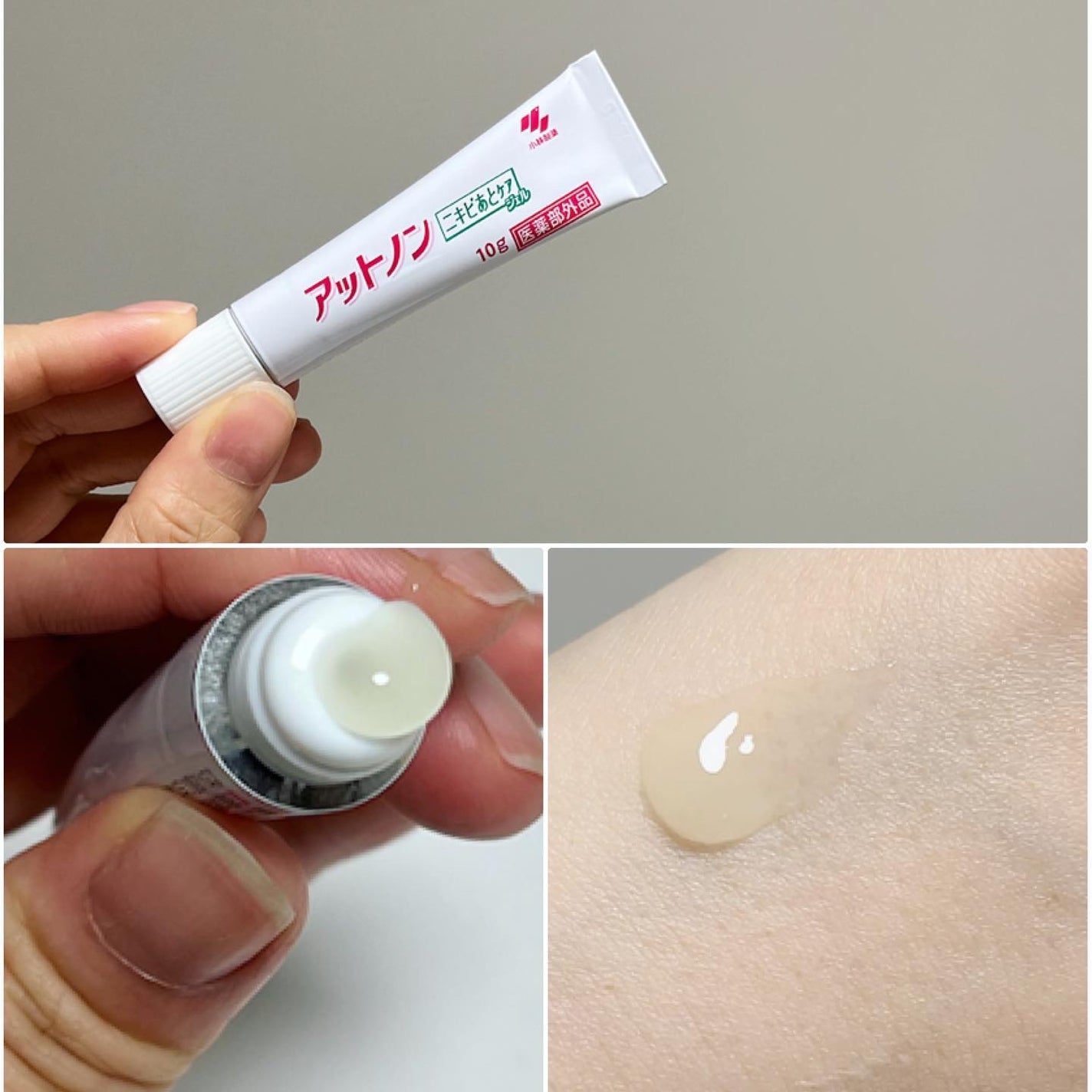 ニキビあとケアジェル/アットノン/その他スキンケアを使ったクチコミ(2枚目)