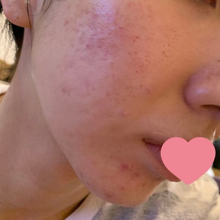 白色ワセリン(医薬品)/健栄製薬/その他を使ったクチコミ(2枚目)