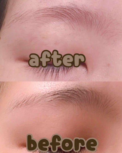 脱色クリーム 敏感肌用/エピラット/ムダ毛ケアを使ったクチコミ(3枚目)