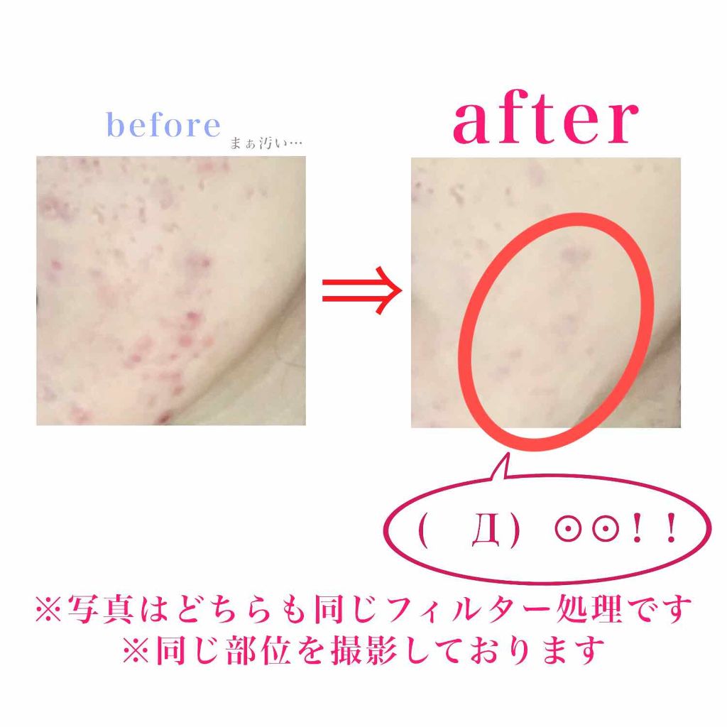 コンシーラー/NOV/クリームコンシーラーを使ったクチコミ(4枚目)