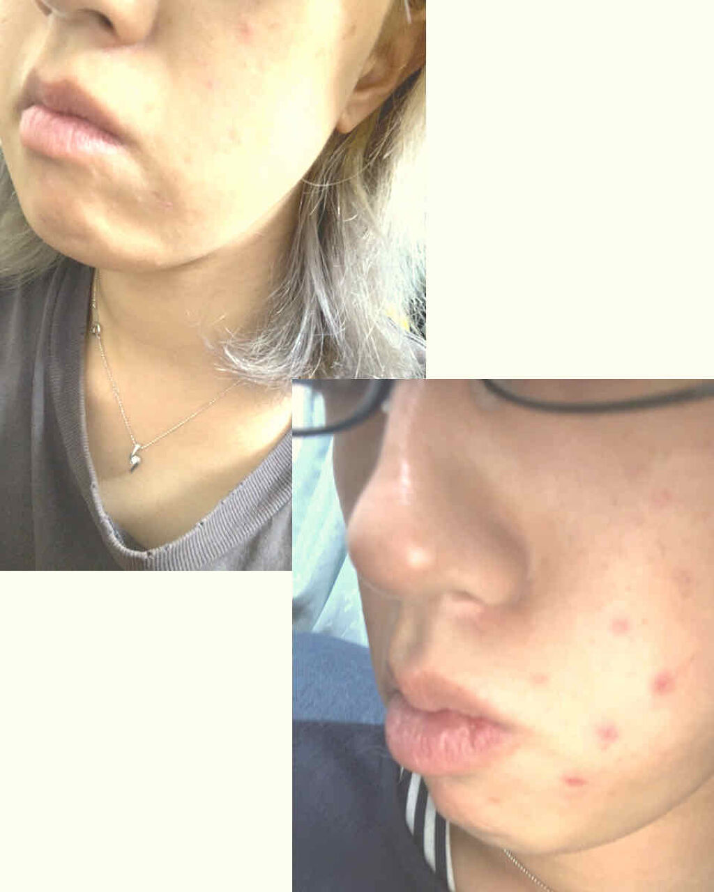 フローラドリップ/ALBION/化粧水を使ったクチコミ（1枚目）