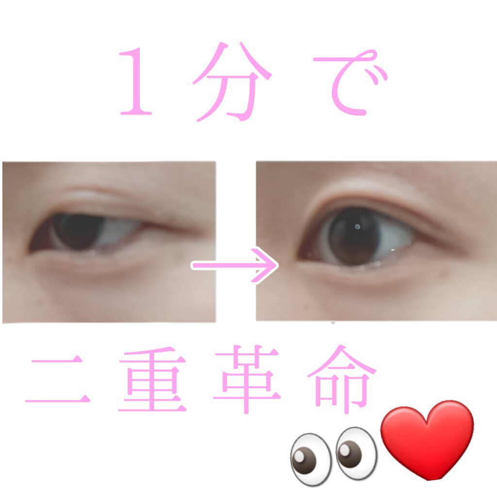 アイビューティー フィクサー WP/アストレア ヴィルゴ/二重まぶた用アイテムを使ったクチコミ（1枚目）