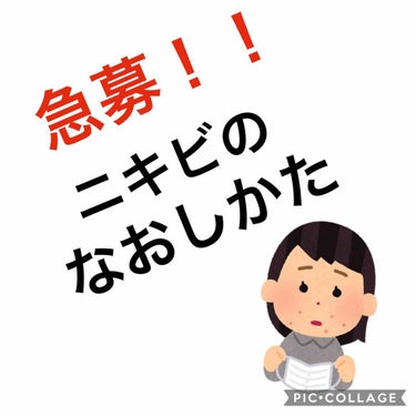 マスクでニキビ爆誕しました☆
なおしかた教えてください！！！！
いい基礎化粧品、薬探してます。

肌の特徴
・汚れに弱い。即ニキビ
・大きいニキビはほぼ無く、毎日白ニキビが10〜20個くらいずつできてい