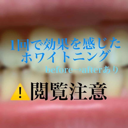 はみがき スペシャル/セッチマ/歯磨き粉を使ったクチコミ(1枚目)