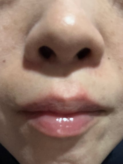 ジェリーシャインリッププランパー/INGA/リッププランパーを使ったクチコミ(5枚目)