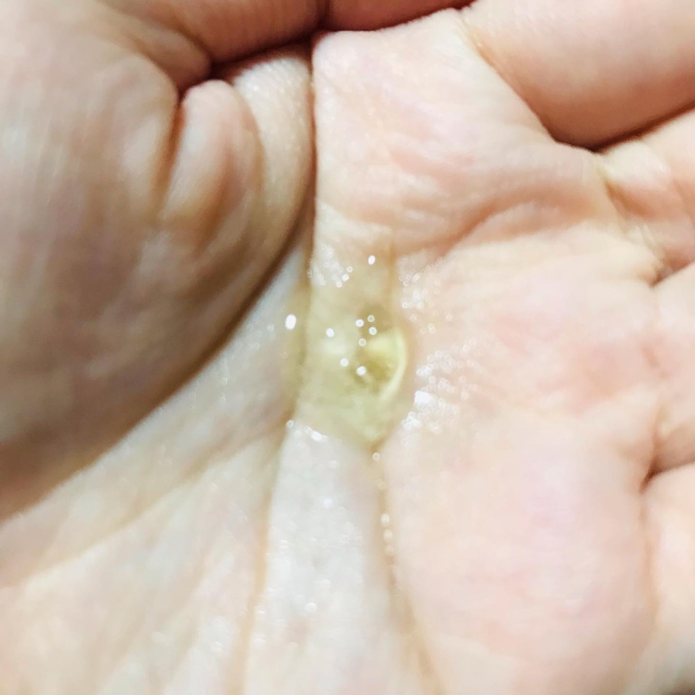 グリーンタンジェリン ビタC ダークスポットケアセラム/goodal/美容液を使ったクチコミ(3枚目)