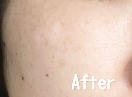 タンイドル ウルトラ ウェア リキッド O-01/LANCOME/リキッドファンデーションを使ったクチコミ(3枚目)