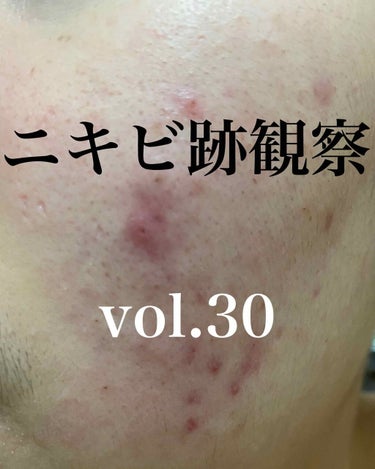 敏感肌用薬用美白美容液/無印良品/美容液を使ったクチコミ（1枚目）