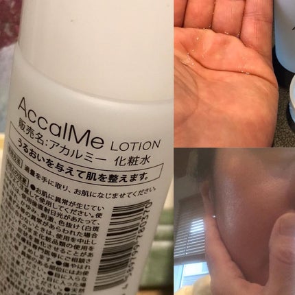 アカルミー セラム/ワイズ製薬/美容液を使ったクチコミ(2枚目)
