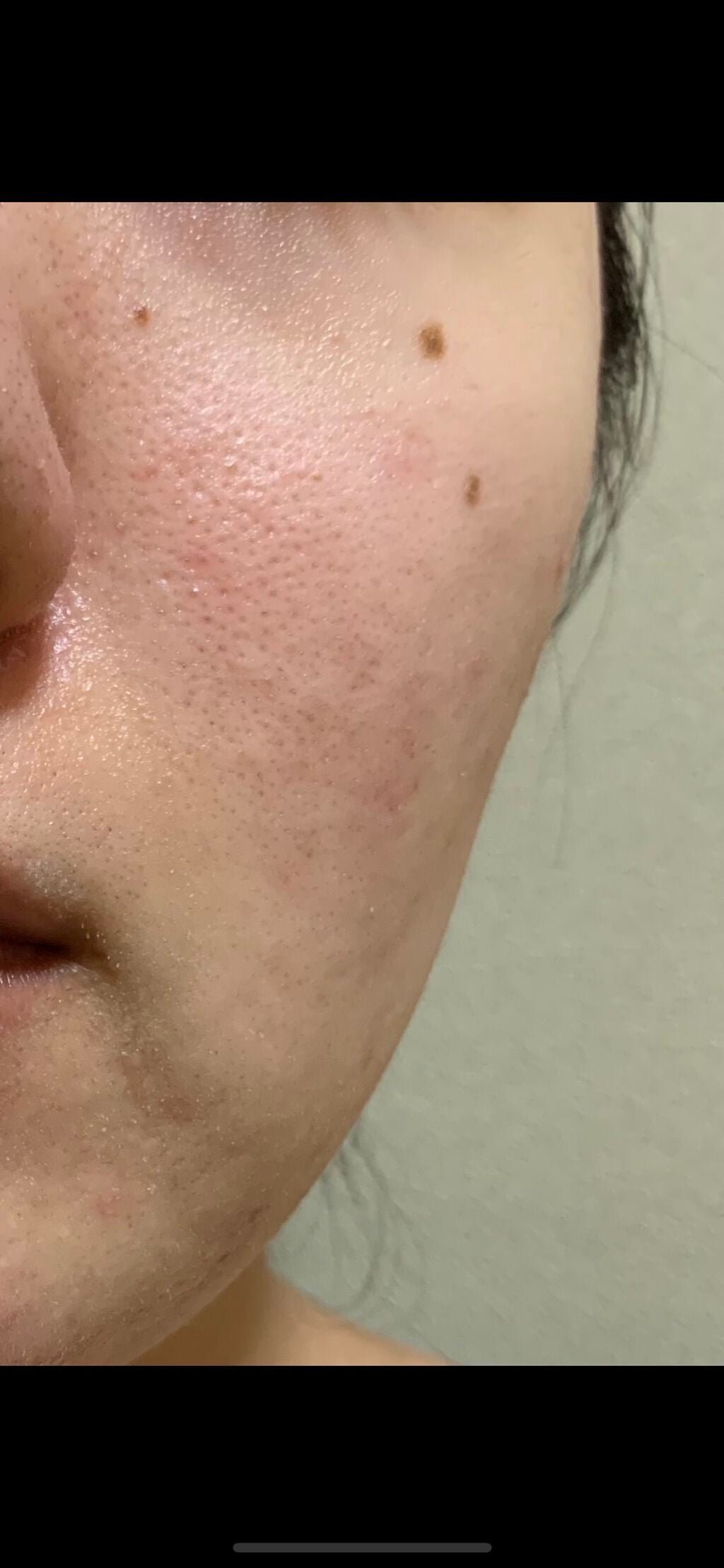 カステラ on LIPS 「⚠️2枚目以降汚いです⚠️肌の調子が良いので記録!🐄スキンケア..」(2枚目)