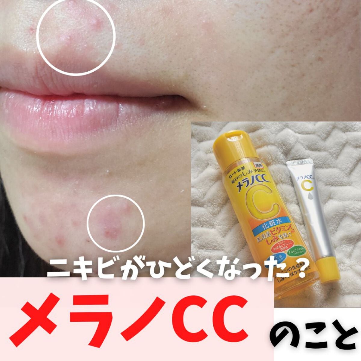 薬用 しみ 集中対策 美容液/メラノCC/美容液を使ったクチコミ(1枚目)