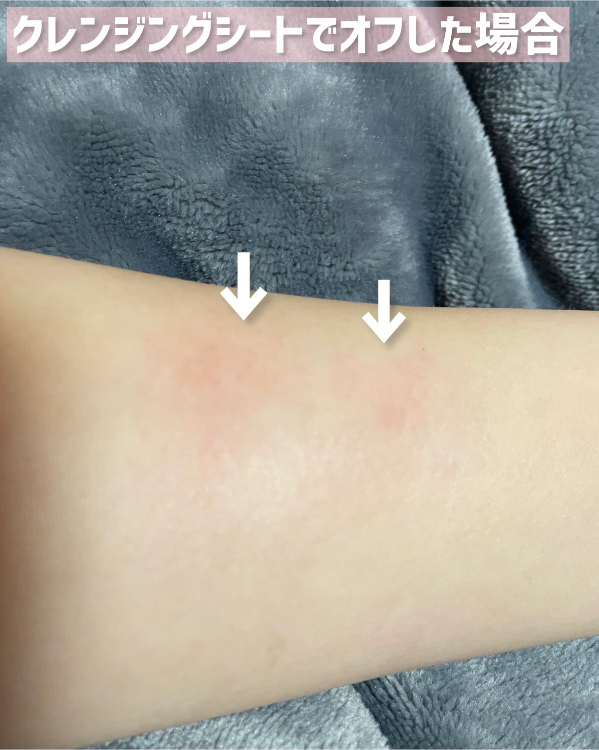 デュイフルウォーターティント<ミルクグロッサリー>/rom&nd/リップティントを使ったクチコミ(7枚目)