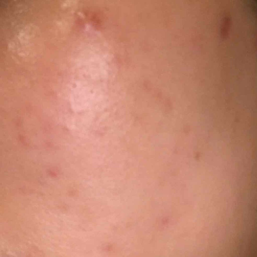 twinkle_lips_c6o on LIPS 「2月4日触ってざらつきが少しなくなったような、肌が白くなったよ..」(2枚目)