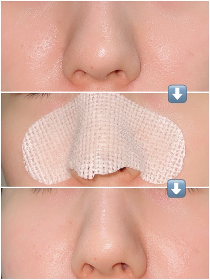 ノーモアブラックヘッド(ノーズピーリング)/One-day's you/スクラブ・ゴマージュを使ったクチコミ(5枚目)