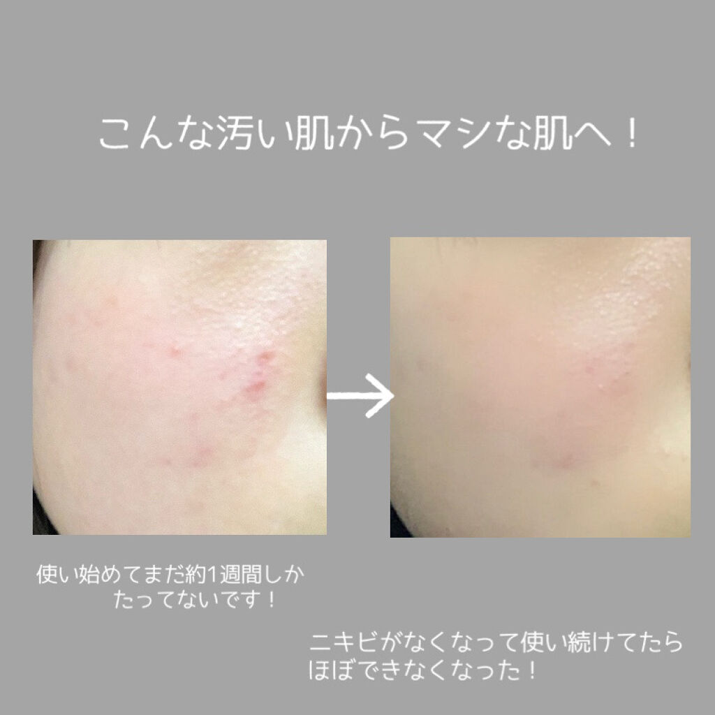 デュオ ザ クレンジングバーム ミニ4種セット/DUO/クレンジングバームを使ったクチコミ（1枚目）