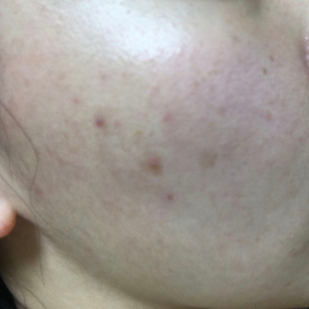 試してみた】デイリーPD/ZO Skin Health | LIPS 試してみた】デイリーPD/ZO Skin Health | LIPS