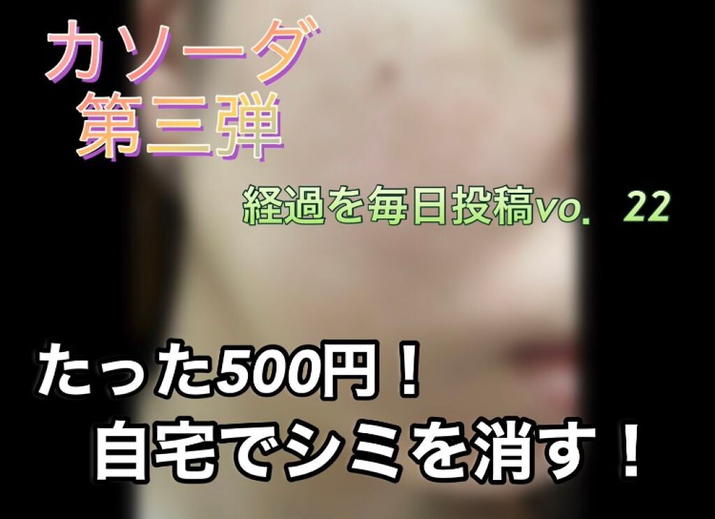 しい on LIPS 「カソーダ22日目順調に皮むけ中!特に鼻がポロポロ!〜カソーダを..」(1枚目)