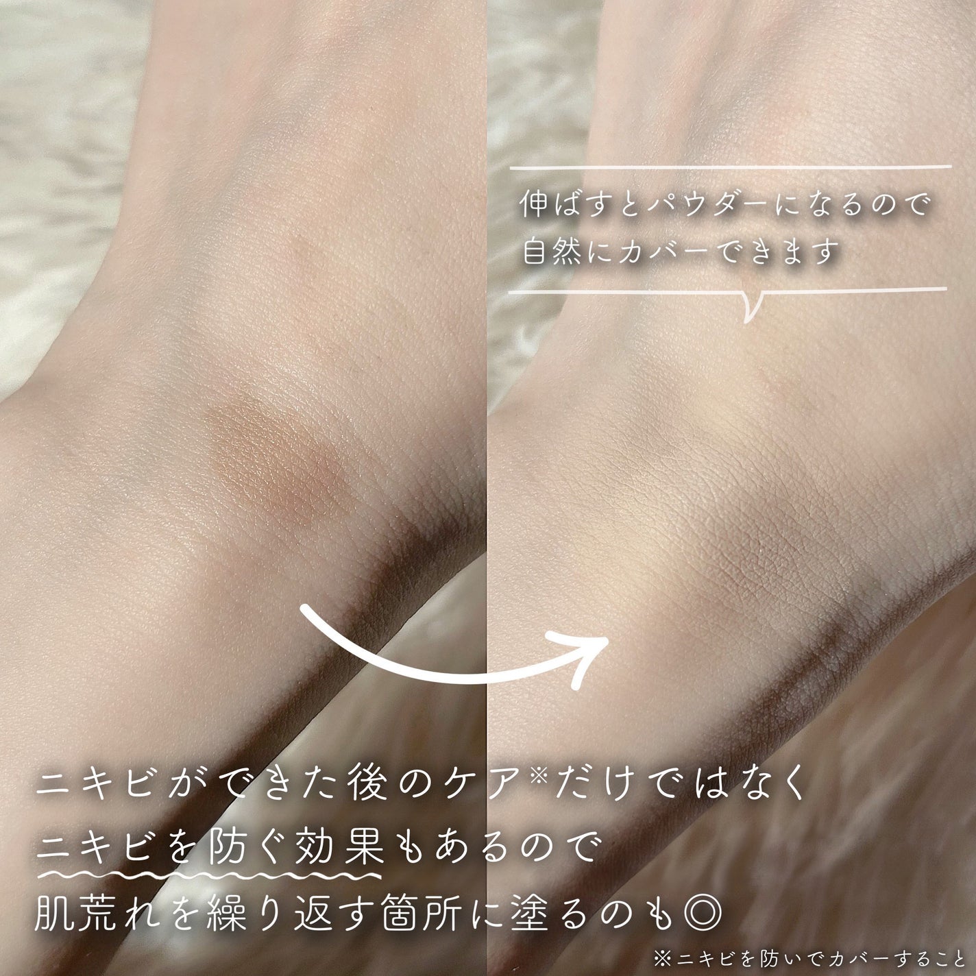 イプノス シーバムクリア リペアクリーム/ACSEINE/フェイスクリームを使ったクチコミ(4枚目)