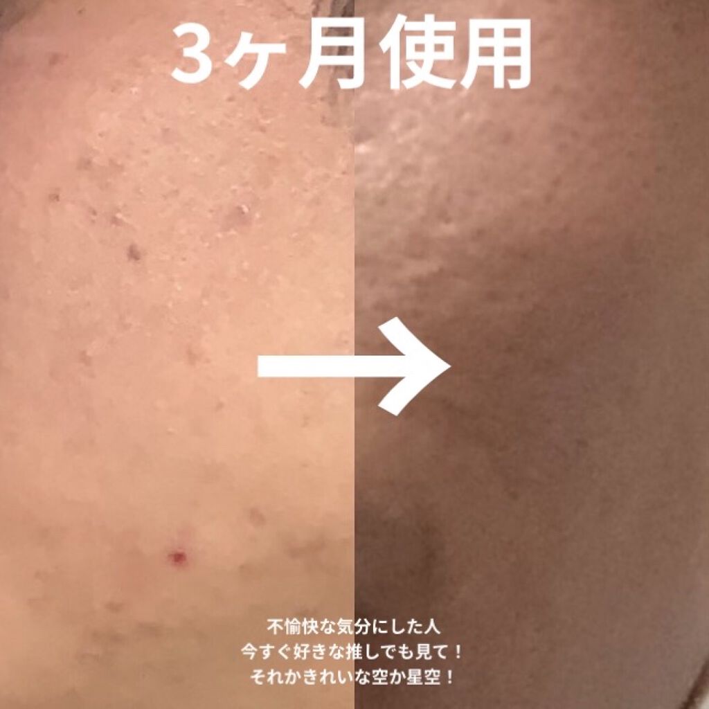 プロポリス エネルギーアンプル/CNP Laboratory/美容液を使ったクチコミ（2枚目）