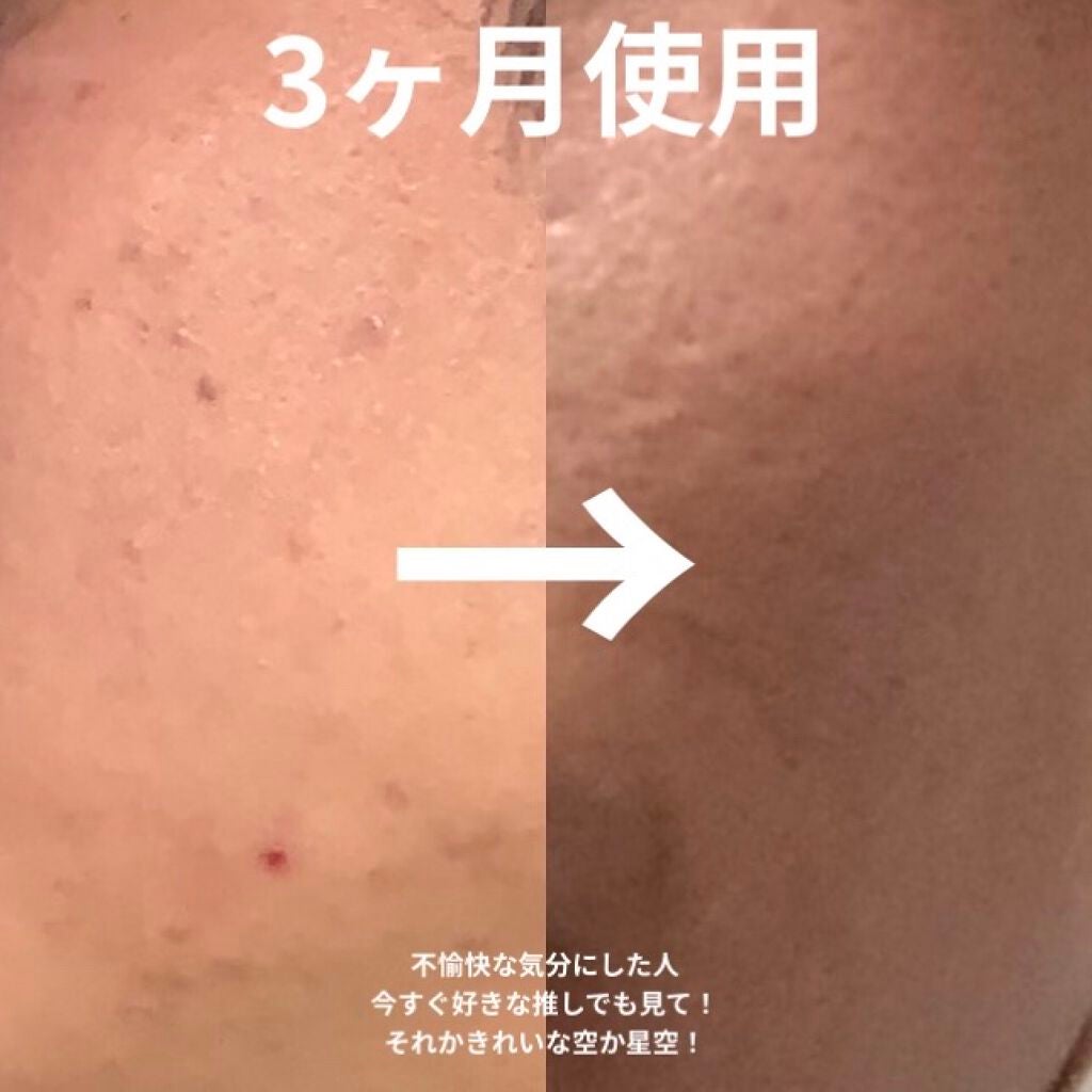 プロポリス エネルギーアンプル/CNP Laboratory/美容液を使ったクチコミ(2枚目)