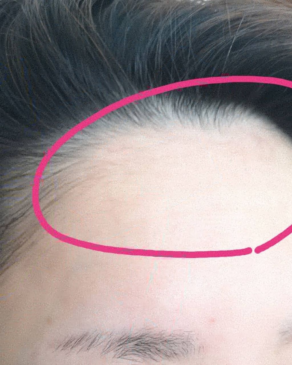 オデコディープパッチ/北の快適工房/シートマスク・パックを使ったクチコミ（3枚目）