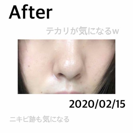 重曹泡洗顔/毛穴撫子/泡洗顔を使ったクチコミ(3枚目)