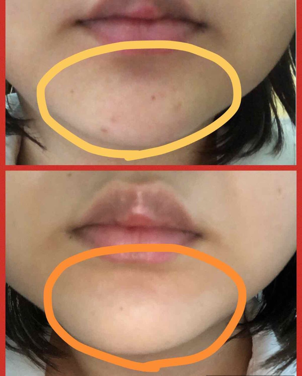 コンシーラークレヨンUV/CEZANNE/ペンシルコンシーラーを使ったクチコミ(4枚目)