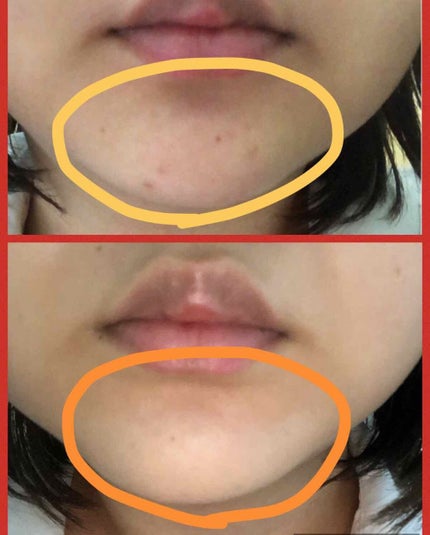 コンシーラークレヨンUV/CEZANNE/ペンシルコンシーラーを使ったクチコミ(4枚目)