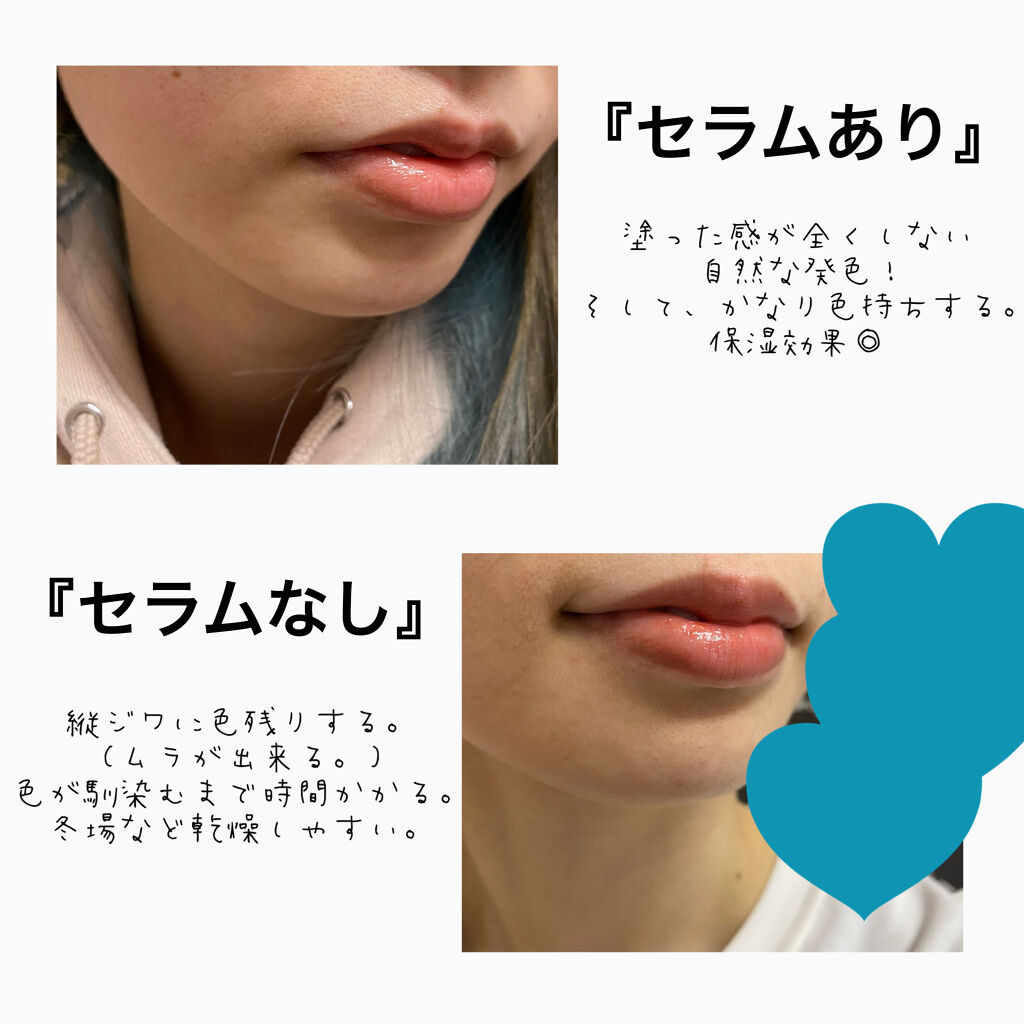 コンディショニングリップセラム/Blistex/リップクリームを使ったクチコミ（3枚目）