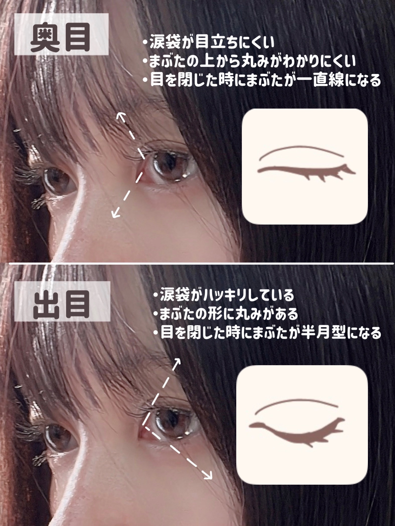 ひとえ・奥ぶたえ用カーラー/アイプチ®/ビューラーを使ったクチコミ（3枚目）