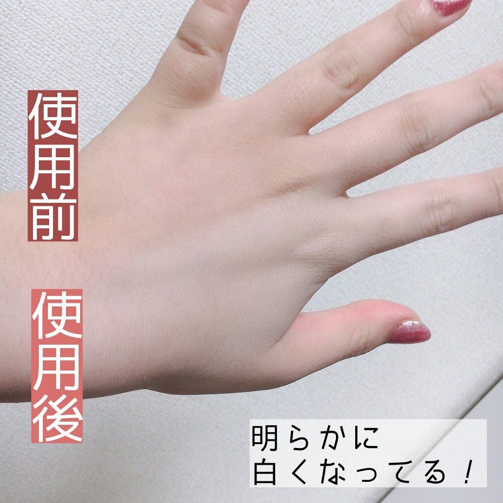 薬用ホワイトコンク ホワイトニングCC CII/ホワイトコンク/ボディクリームを使ったクチコミ(3枚目)