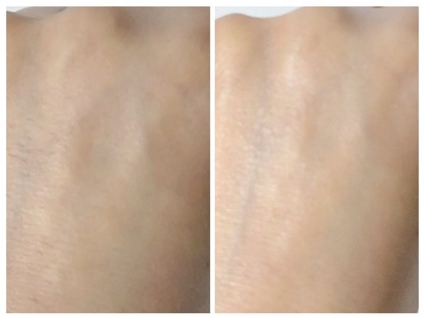 ピオニーペプチドクリーム/goodal/フェイスクリームを使ったクチコミ(6枚目)