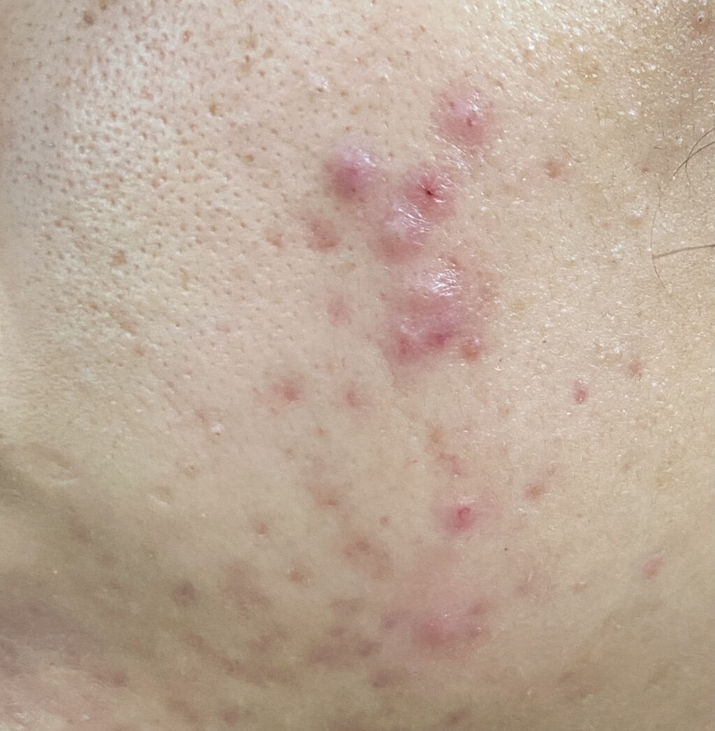 ホホバオイル/無印良品/ボディオイルを使ったクチコミ（3枚目）