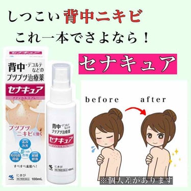 セナキュア(医薬品)/小林製薬/その他を使ったクチコミ（1枚目）