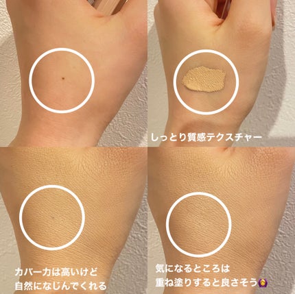 ダーマシンコンシーラー/23years old/リキッドコンシーラーを使ったクチコミ(2枚目)